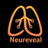 Neureveal